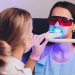 beyond vs. led – którą metodę wybielania zębów wybrać